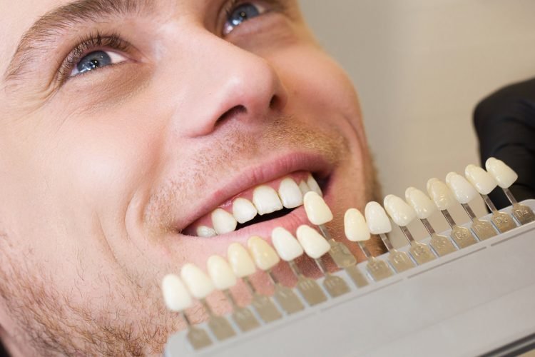 Patient comparing their teeth with a dental shade guide