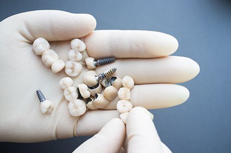 Dental crowns and implant components held by a clinician