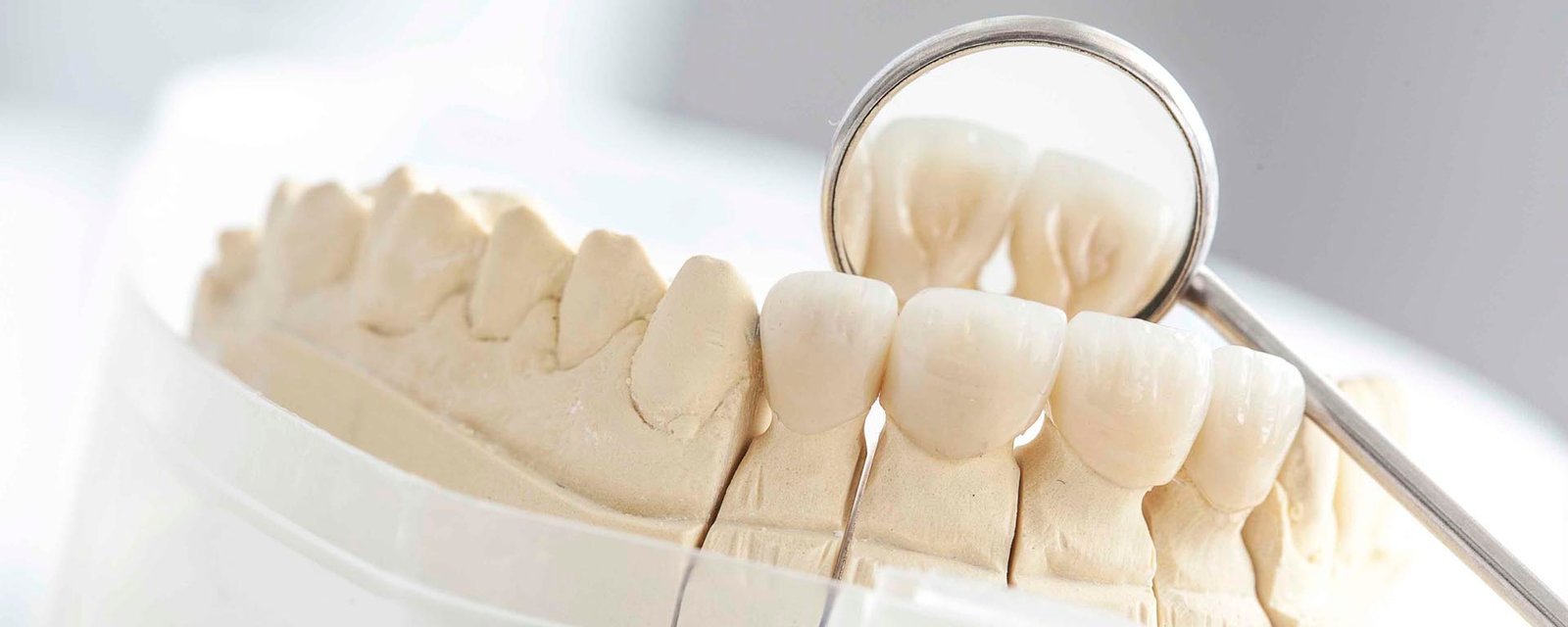 Porcelain crowns on a dental model beside a mirror